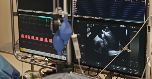 ICBA realiza el primer procedimiento con PulseSelect™ en Argentina